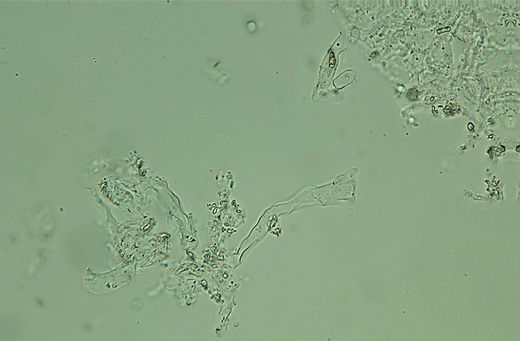 Vuilleminia sp. con cistidi giganti (Vuilleminia comedens)